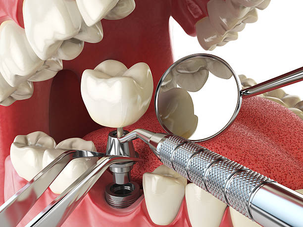 Best Emergency Dentist for Special Needs Patients in Alanuk, AK
